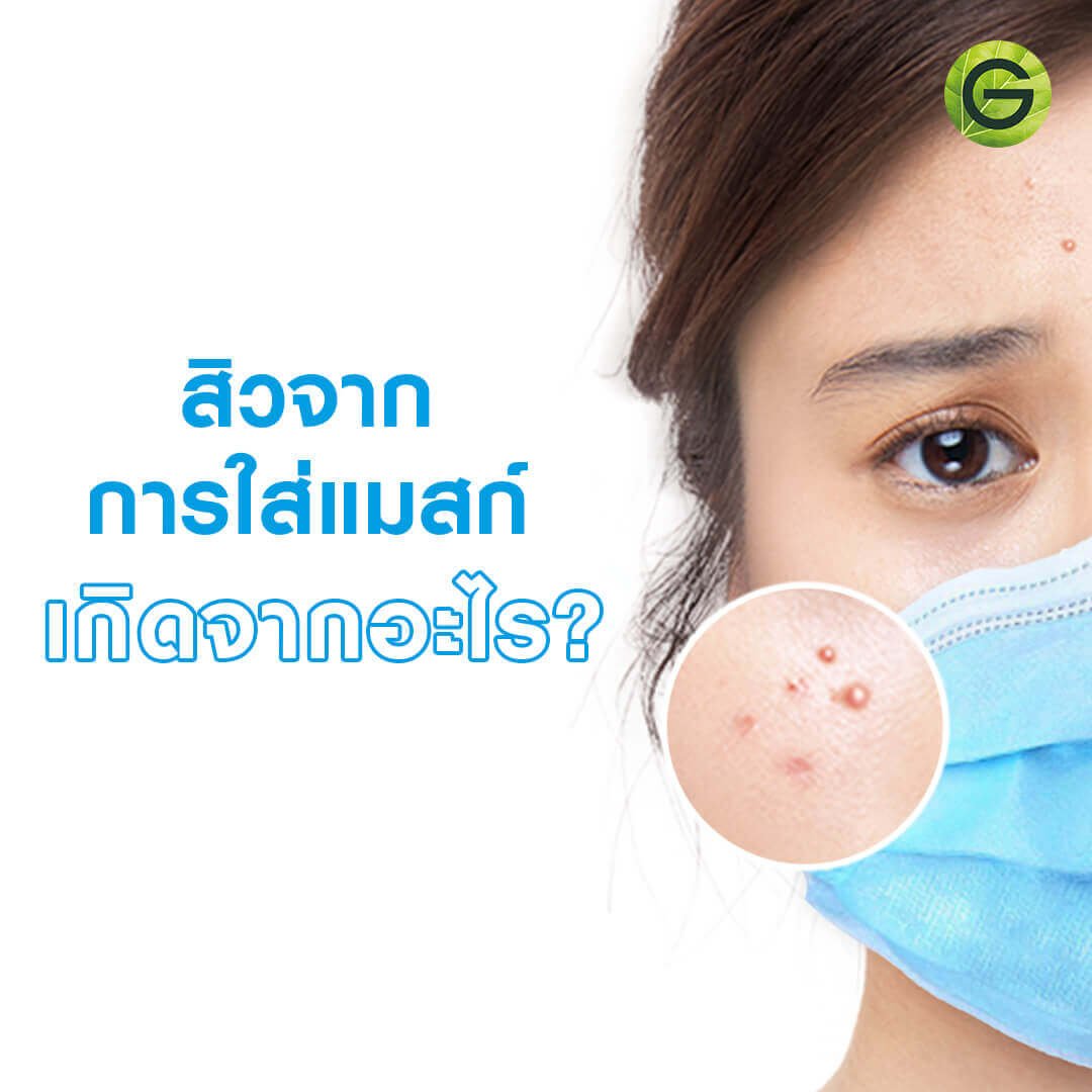 ปัญหาสิว