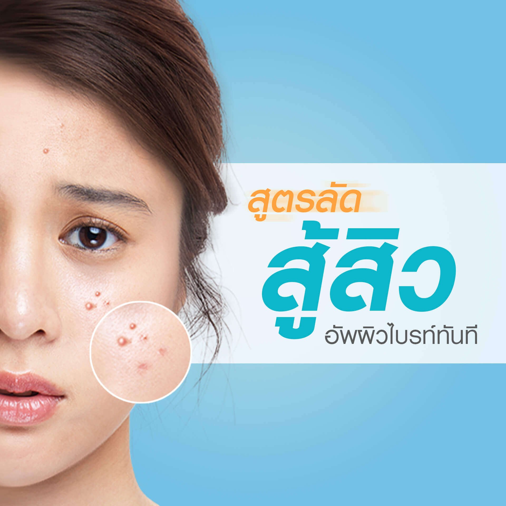 สูตรลัดสู้สิวอัพผิวไบรท์ทันที