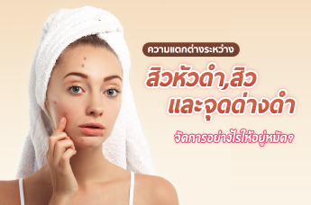 ความแตกต่างระหว่าง สิวหัวดำ สิว และ จุดด่างดำ จัดการอย่างไรให้อยู่หมัด