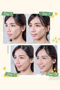 หน้าสวยใสภายใน 3 วัน ด้วยบูสเตอร์ เซรั่มหน้าใส วิตซีเข้มข้น