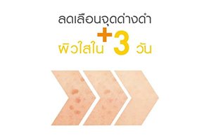 ลดเลือนจุดด่างดำ เผยผิวใสใน 3 วัน