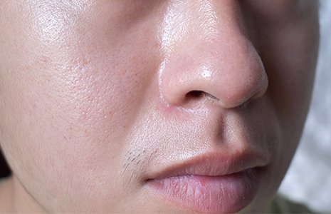 โฟมล้างหน้าผู้ชายสูตรชาร์โคล ช่วยลดความมันบนผิวหน้า