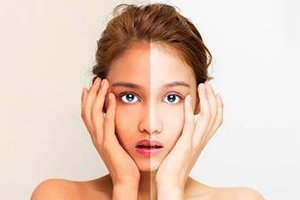 เปรียบเทียบสีผิวหมองคล้ำและสีผิวกระจ่างใส