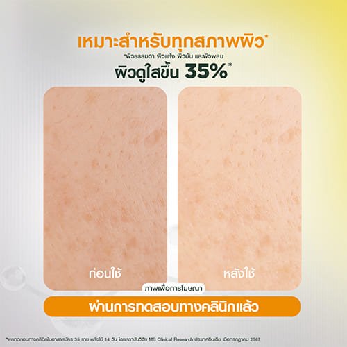 การ์นิเย่