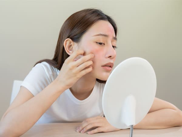 ผิวเครียด