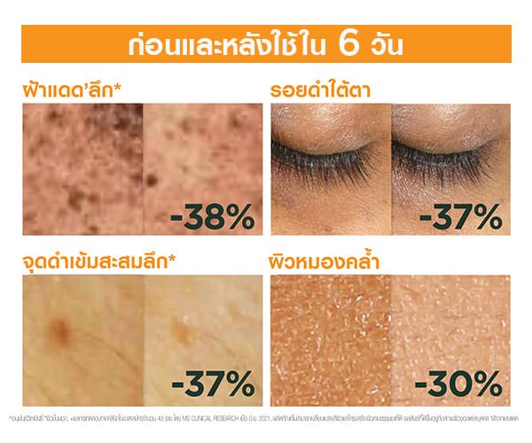 เซรั่มลดฝ้าแดด