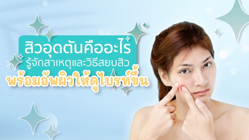 เซรั่มลดสิว