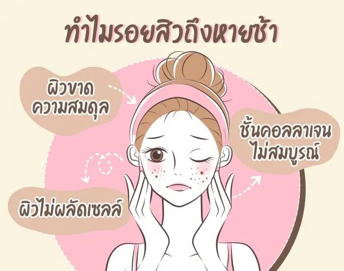 รอยสิวหายช้า