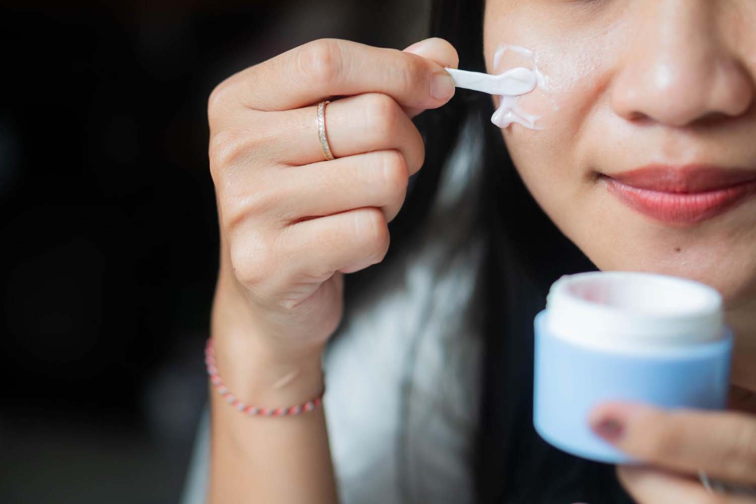 ครีมลดรอยสิว