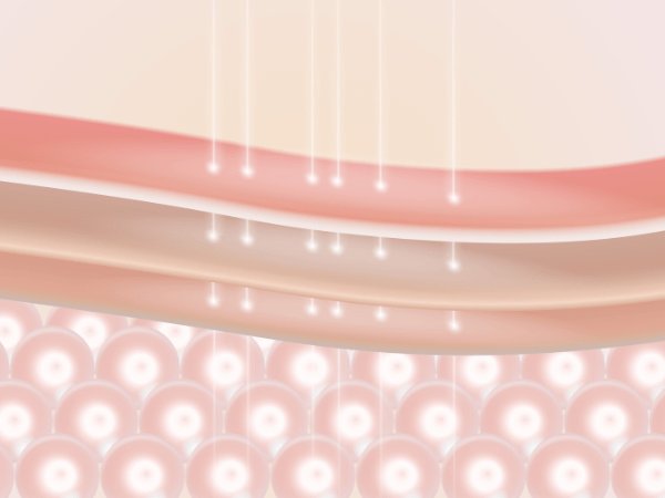 เซราไมด์ ใช้ยังไง