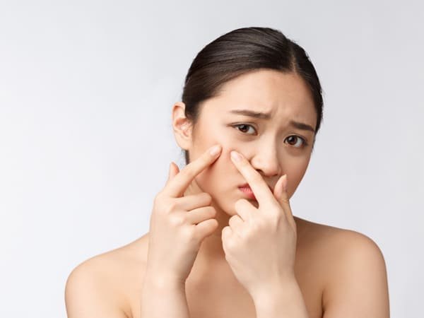 รักษาสิว