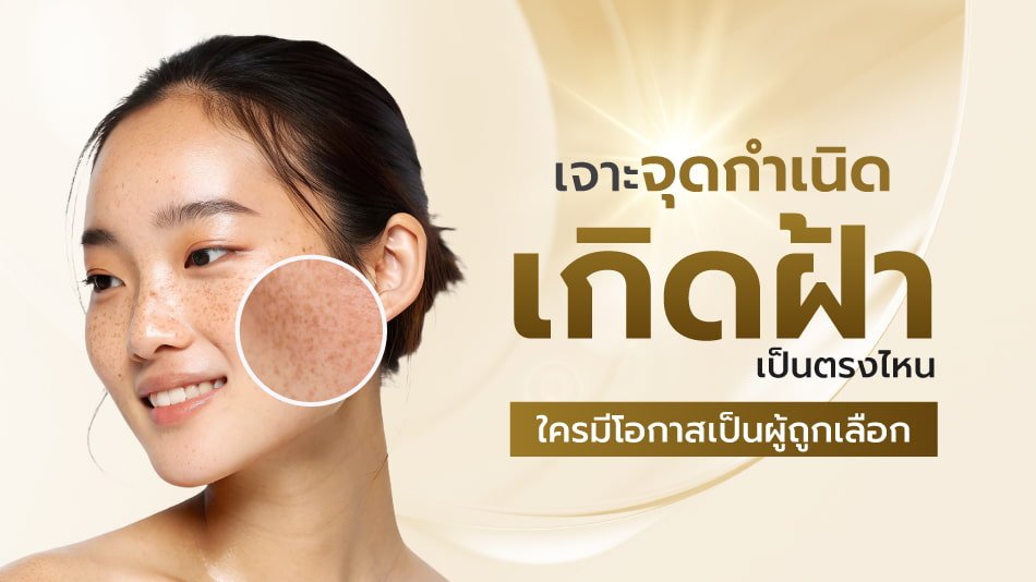 ฝ้า Garnier