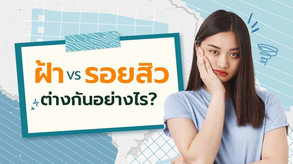 เซรั่มลดรอยสิว ฝ้า