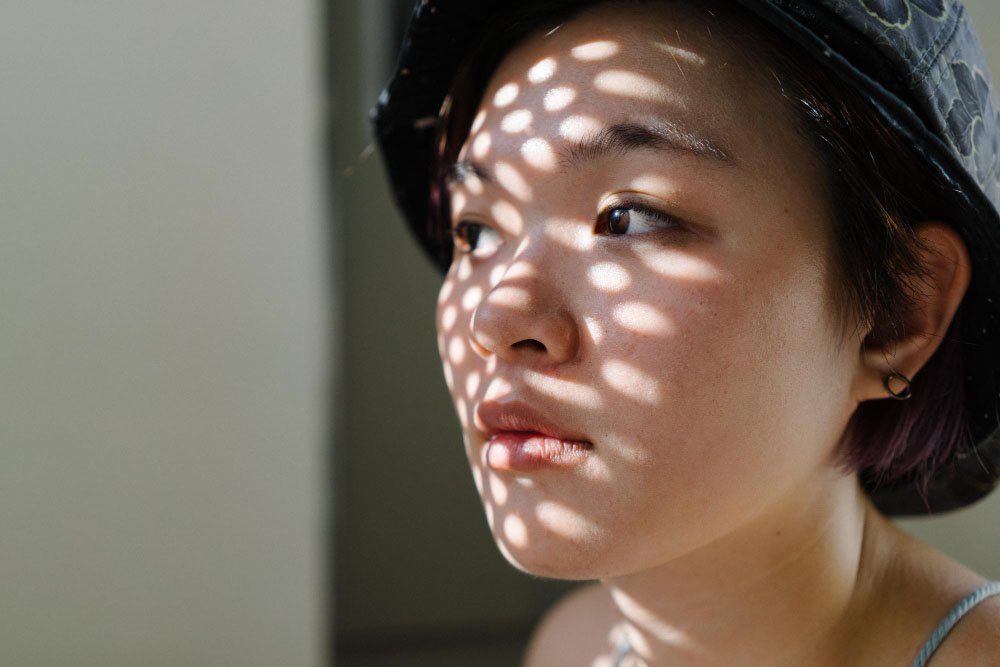 ฝ้าเกิดจากอะไร