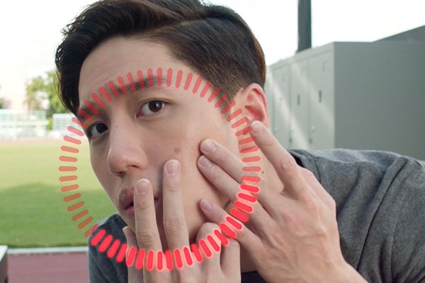 ผู้ชายเป็นสิว