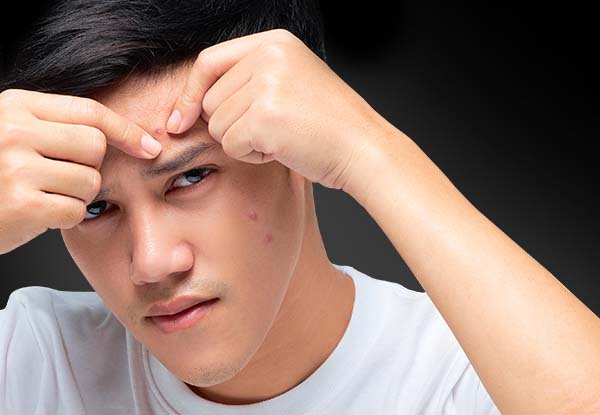 หมดปัญหาสิว ด้วยโฟมล้างหน้าผู้ชาย สำหรับผิวแพ้ง่าย